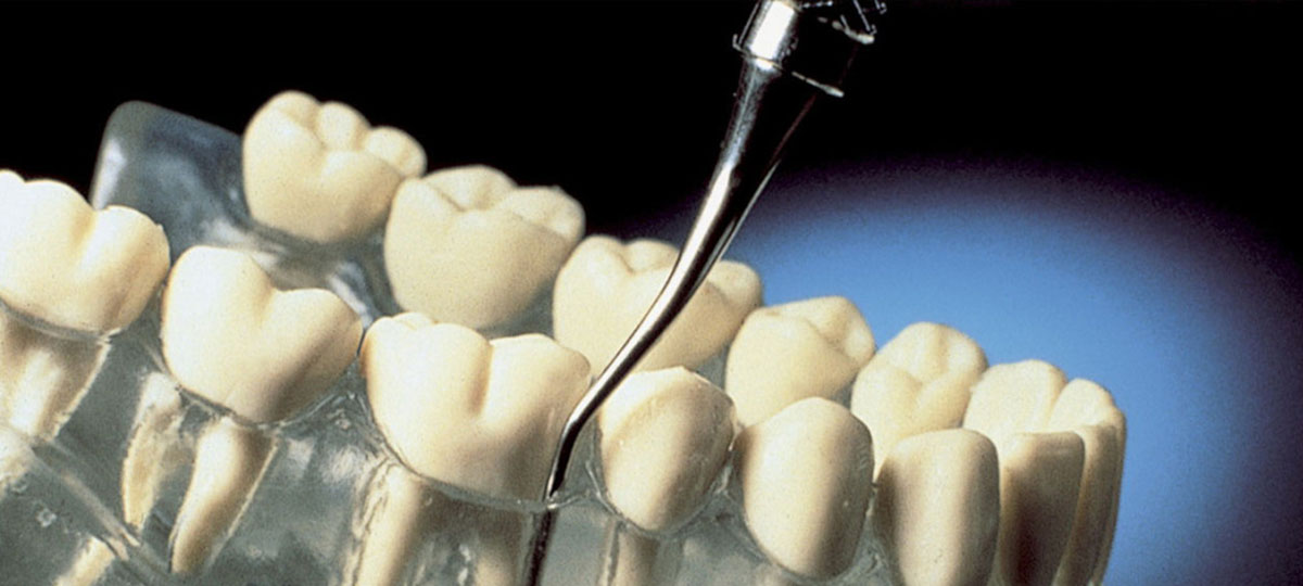 Periodontal Treatment Tonawanda Dentist